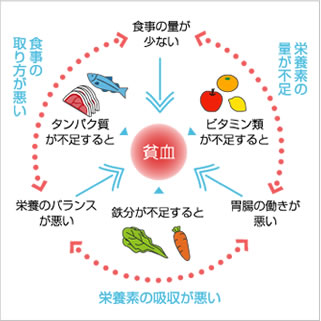 たんぱく質・ビタミン類・鉄分が不足すると >> 貧血