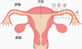 子宮図